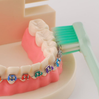 Зубная щётка для брекетов OrthodonticsToothbrush /  Y-Kelin5