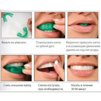 Набор для домашнего отбеливания зубов - Мята. "Opalescence Treswhite Supreme Mint" (UL 5706) / ULTRADENT1